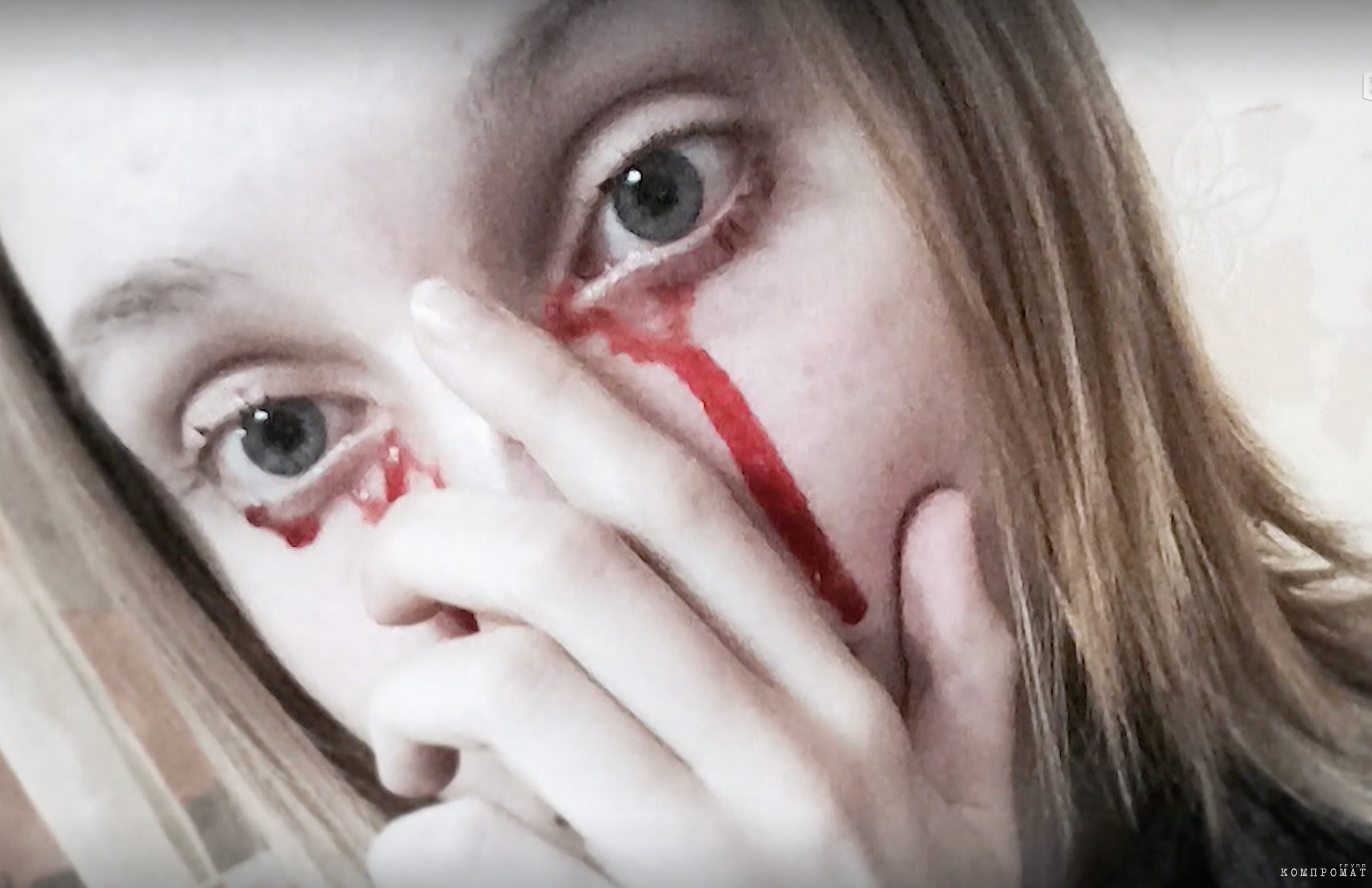The photo shows that the "blood" under the girl