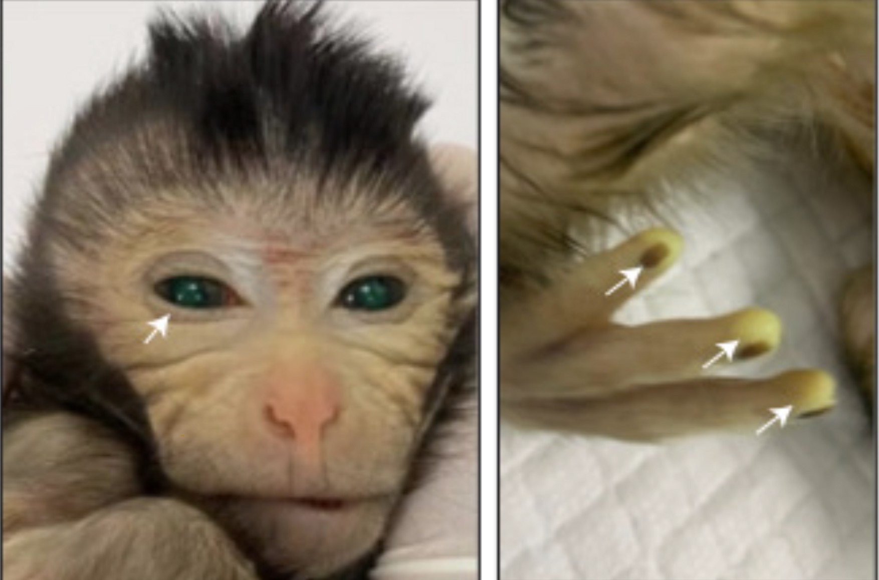In China a chimera monkey was created from two sets In China, a chimera monkey was created from two sets of DNA. Scientists hope this breakthrough will help treat ALS in humans