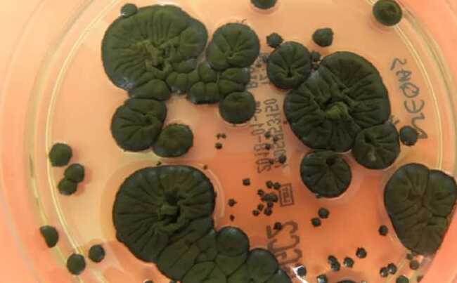 At the Chernobyl Nuclear Power Station, a fungus able to transform radiation into power has been unearthed.